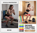 Resistance Bands for Working Out | 5-Pack Exercise Bands for Home Gym,Glute bands